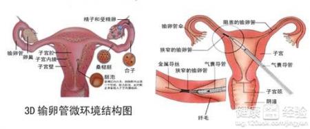 输精管堵塞的饮食原则有哪些